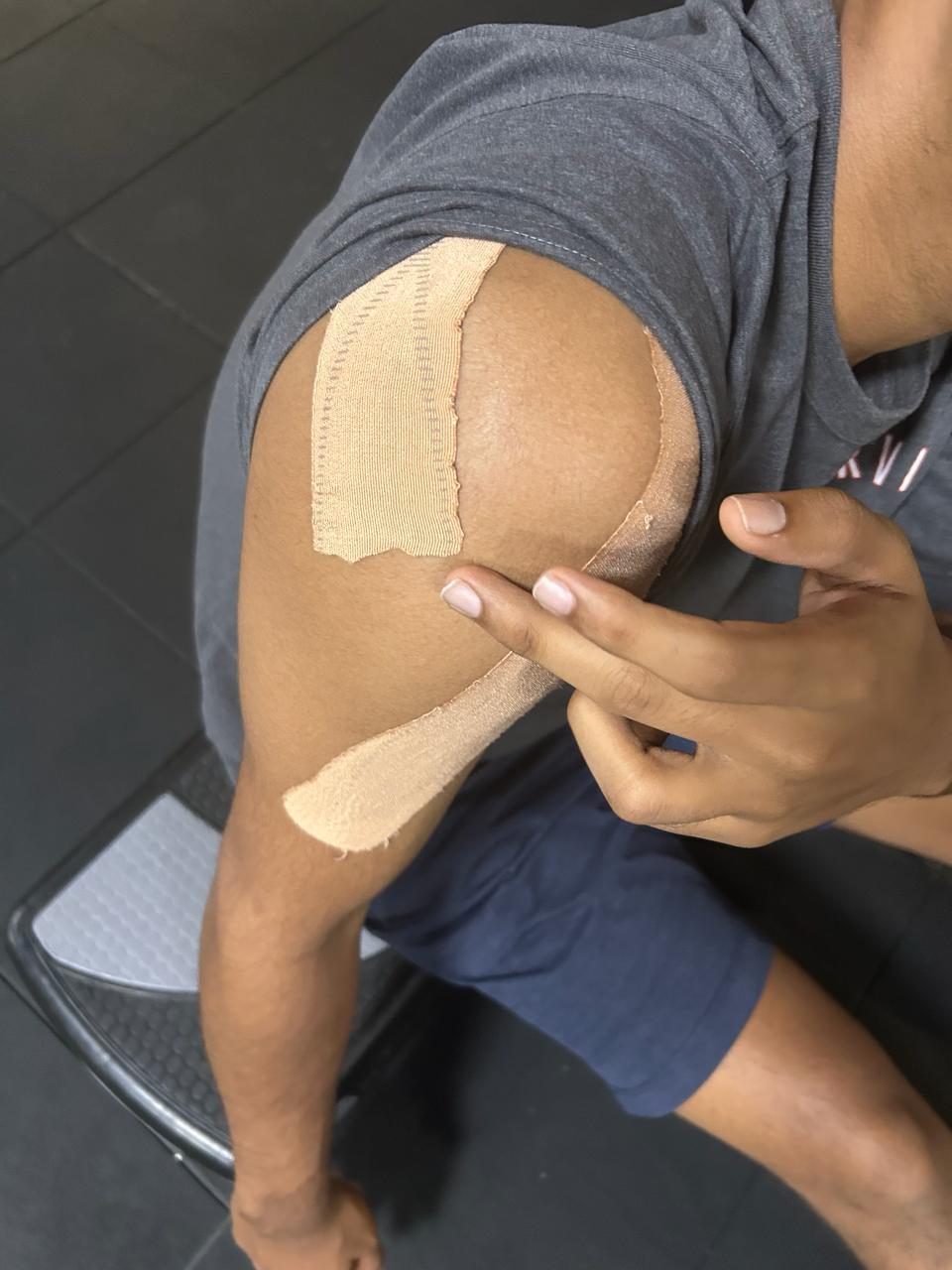 Injury